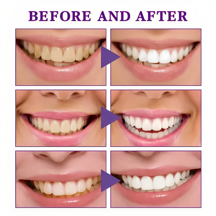 Purple Foaming Teeth Whitening Oral Refreshing